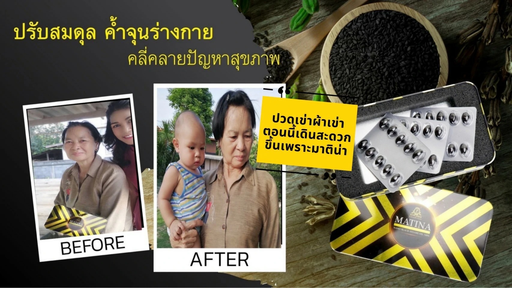 ประสบการณ์ผู้เคยทานมาทีน่า แล้วได้ผล