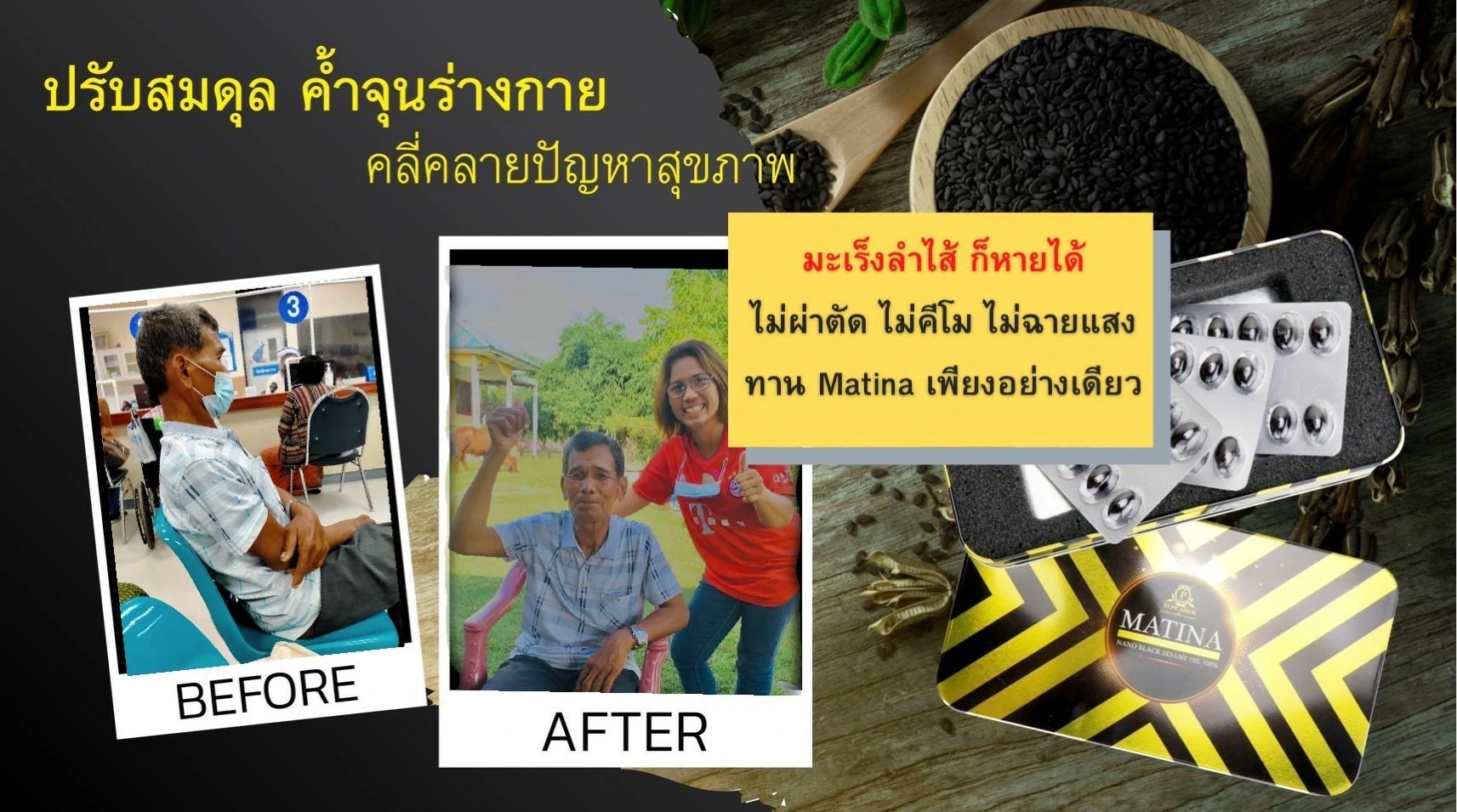 ประสบการณ์ผู้เคยทานมาทีน่า แล้วได้ผล