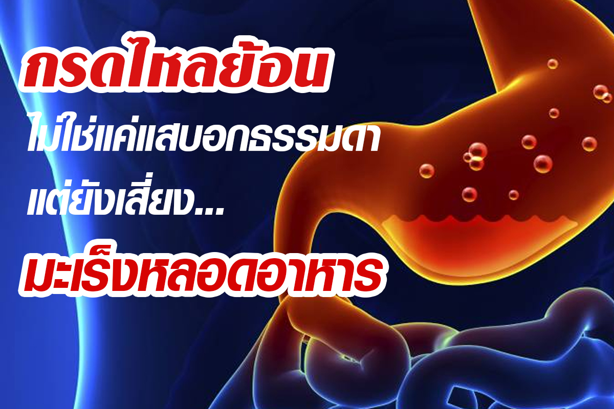 โรคกรดไหลย้อน