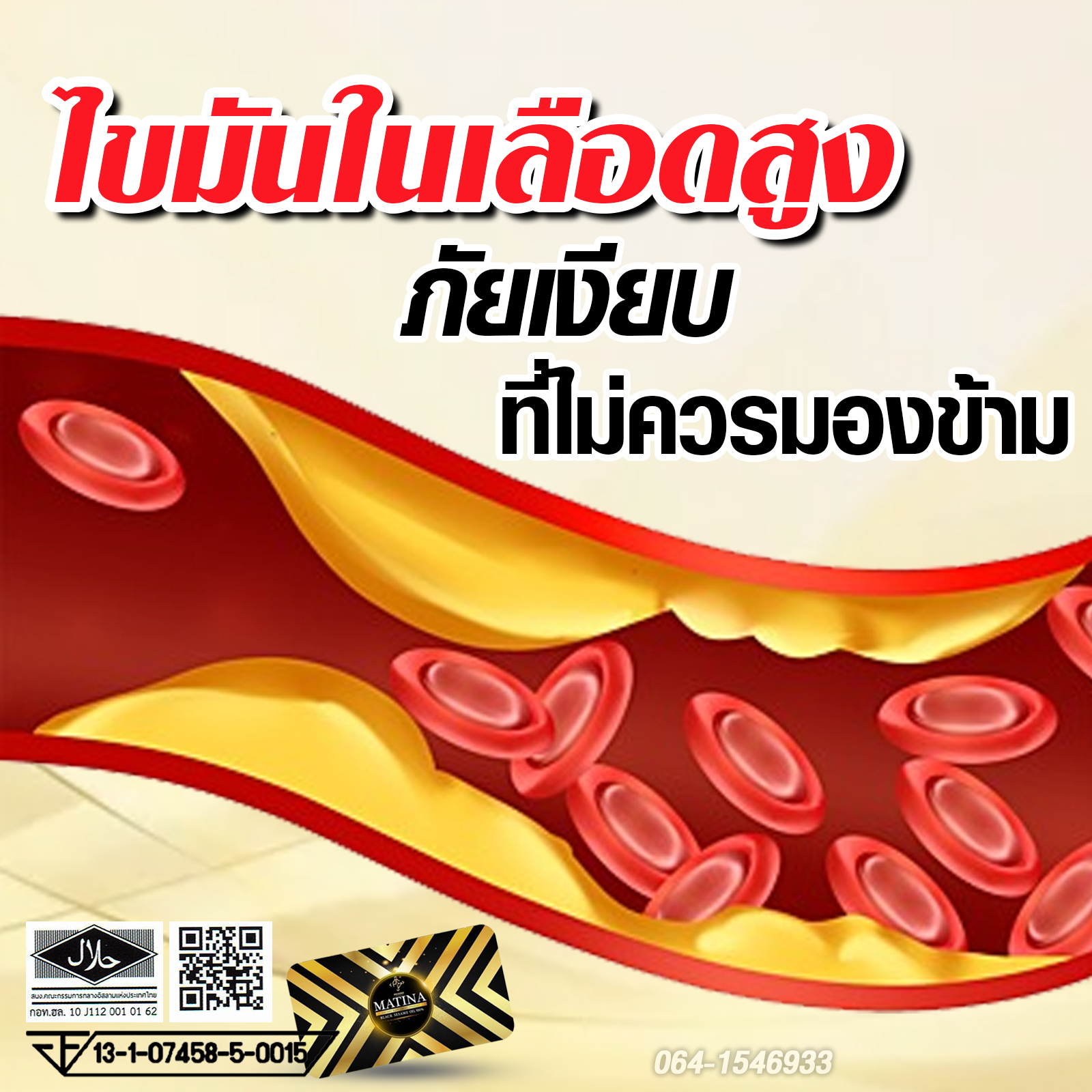 ภัยจากไขมันในเลือดสูง