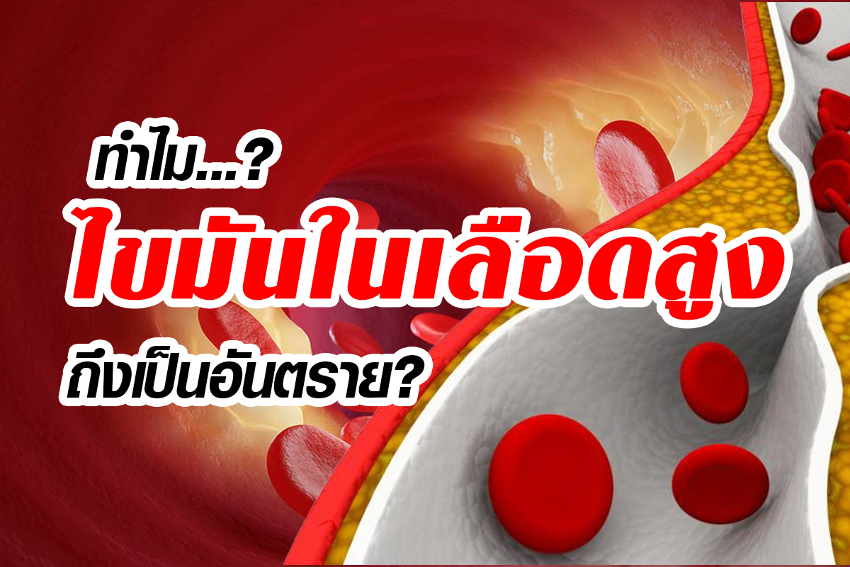 อันตรายจากไขมันในเลือดสูง