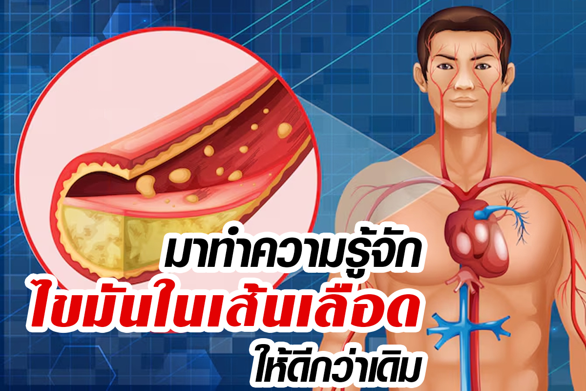 ไขมันในเลือดคืออะไร