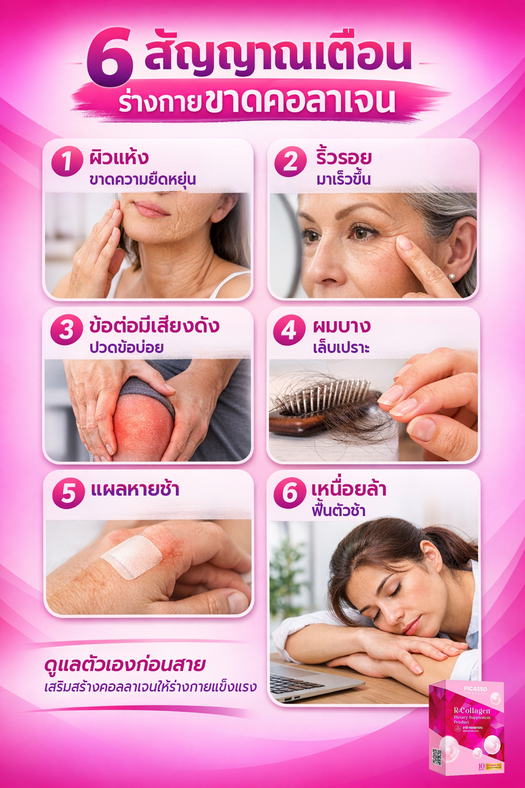 6 สัญญาณเตือน ร่างกายขาดคอลลาเจน 6 สัญญาณเตือน ร่างกายขาดคอลลาเจน